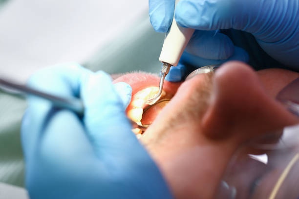 Best Walk-In Emergency Dentist in Lauderhill, FL