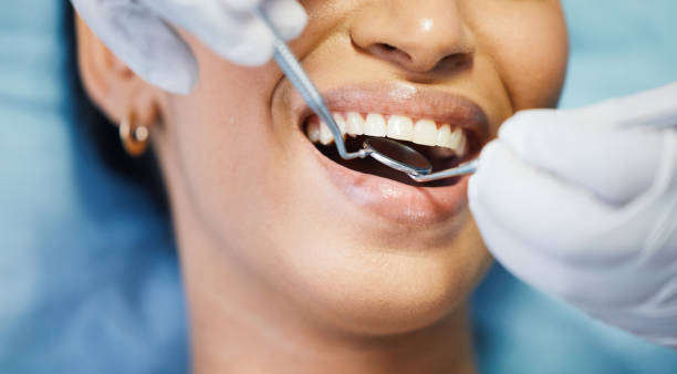 Best Emergency Wisdom Teeth Removal in Lauderhill, FL