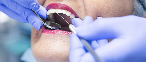 Best Emergency Broken Tooth Repair in Lauderhill, FL